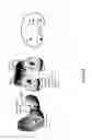 Fig. 26 - SYSTEMS AND METHODS OF IMPLANTS TO RESTORE PATIENT SPECIFIC FUNCTON