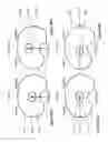 Fig. 40 - SYSTEMS AND METHODS OF IMPLANTS TO RESTORE PATIENT SPECIFIC FUNCTON