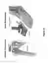 Fig. 43 - SYSTEMS AND METHODS OF IMPLANTS TO RESTORE PATIENT SPECIFIC FUNCTON