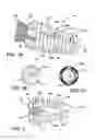 Fig. 02 - Expandable subtalar joint implant and insertion device