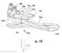 Fig. 53 - Hybrid terrain—adaptive lower-extremity systems