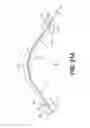 Fig. 41 - Stent with anti-migration devices