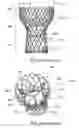 Fig. 02 - Stent assemblies including passages to provide blood flow to coronary arteries and methods of delivering and deploying such stent assemblies