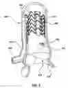 Fig. 09 - Stent assemblies including passages to provide blood flow to coronary arteries and methods of delivering and deploying such stent assemblies