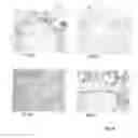 Fig. 07 - WOUND CONTACTING MEMBERS AND METHODS