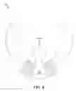 Fig. 09 - Sexual stimulation device