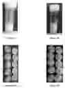 Fig. 02 - High-pH solid-state epinephrine formulation