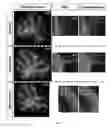 Fig. 10 - Method of promoting remyelination
