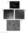 Fig. 02 - Use of Sigma-1 receptor agonist compounds