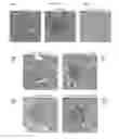 Fig. 09 - Use of Sigma-1 receptor agonist compounds