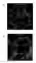 Fig. 22 - Use of Sigma-1 receptor agonist compounds