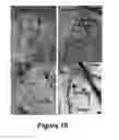 Fig. 07 - Use of H3K9me3 modulation for enhancing cognitive function