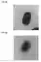 Fig. 08 - Bacterial inhibitors