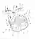 Fig. 49 - Sterilization container capable of providing an indication regarding whether or not surgical instruments sterilized in the container were properly sterilized