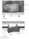 Fig. 08 - Hemorrhage management system
