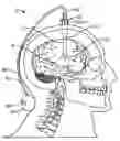 Fig. 01 - APPARATUS, SYSTEMS AND METHODS FOR THE TREATMENT OF NEUROLOGICAL CONDITIONS