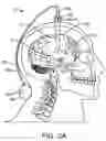 Fig. 03 - APPARATUS, SYSTEMS AND METHODS FOR THE TREATMENT OF NEUROLOGICAL CONDITIONS