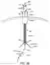 Fig. 04 - APPARATUS, SYSTEMS AND METHODS FOR THE TREATMENT OF NEUROLOGICAL CONDITIONS