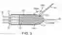 Fig. 07 - APPARATUS, SYSTEMS AND METHODS FOR THE TREATMENT OF NEUROLOGICAL CONDITIONS