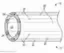 Fig. 01 - Echogenic catheter and catheter system