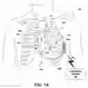 Fig. 02 - Cardiac resynchronization therapy diagnostics