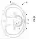 Fig. 04 - Cardiac resynchronization therapy diagnostics
