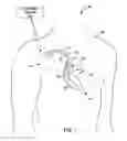 Fig. 02 - Power source longevity