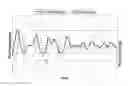 Fig. 01 - Process for controlling the roll and/or pitch motion of a ship with null or low ship speed