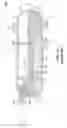 Fig. 02 - Controlled high pressure separator for production fluids