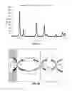 Fig. 02 - Composite micro-sensor for detecting free radicals