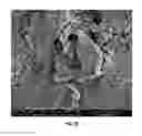 Fig. 08 - Composite micro-sensor for detecting free radicals