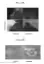 Fig. 22 - Nanodiamond particles and related devices and methods