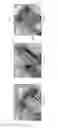 Fig. 09 - Device for subcutaneous delivery of fluid medicament