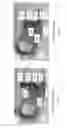 Fig. 35 - Device for subcutaneous delivery of fluid medicament