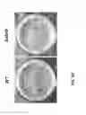 Fig. 07 - Method of generating bacterial compositions