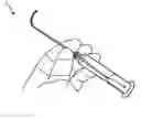 Fig. 01 - Device with bendable distal portion and system actuating the distal portion of the device