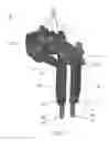 Fig. 02 - Devices and systems for surgical retraction