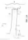 Fig. 02 - Methods for diagnosing and delivering therapeutic interventions in the peritoneal cavity