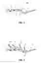 Fig. 02 - Systems and methods for endoscopic submucosal dissection using magnetically attachable clips