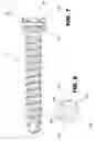 Fig. 07 - Instrument for aligning fixing screws to be inserted in transverse holes of nails for long bones, in particular medullary nails