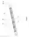 Fig. 07 - Flexible surgical device for tissue removal