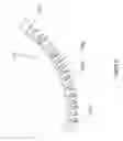 Fig. 09 - Flexible surgical device for tissue removal