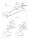Fig. 02 - Uterine hemorrhage controlling system and method