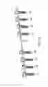 Fig. 09 - Intervertebral fusion implant