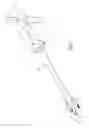 Fig. 02 - Osteotome extractor