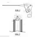 Fig. 02 - System and device for treating body tissue
