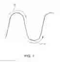 Fig. 02 - Elastic stent graft