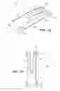 Fig. 02 - Scleral prosthesis for treating presbyopia and other eye disorders and related devices and methods