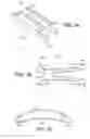 Fig. 04 - Scleral prosthesis for treating presbyopia and other eye disorders and related devices and methods