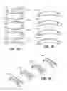 Fig. 05 - Scleral prosthesis for treating presbyopia and other eye disorders and related devices and methods